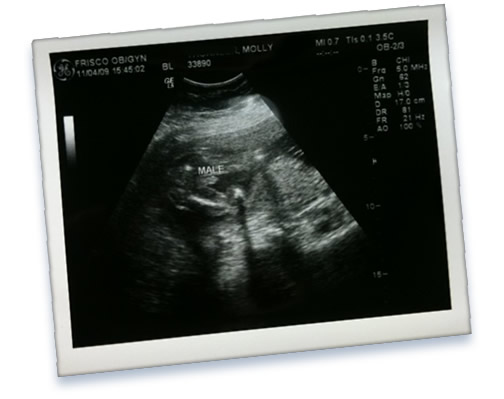 ultrasound
