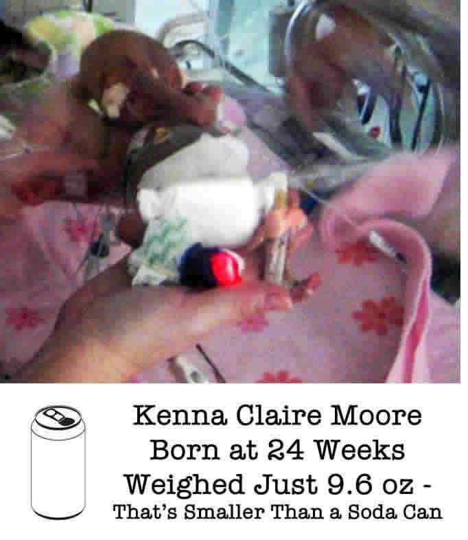 The Story of a Baby Born at 24 Weeks